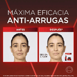 Revitalift Laser Sérum Triple Acción Anti-Edad – 30 ml