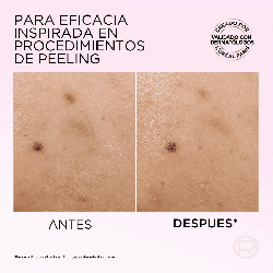 Glycolic Bright Peeling Anti-Manchas 25 ml