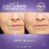 Revitalift Ácido Hialurónico Sérum 30 ml