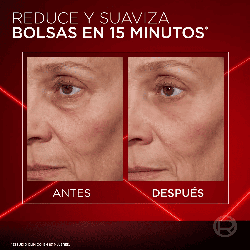 Revitalift Laser Sérum Triple Acción Anti-Edad – 30 ml
