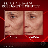 Revitalift Laser Sérum Triple Acción Anti-Edad – 30 ml